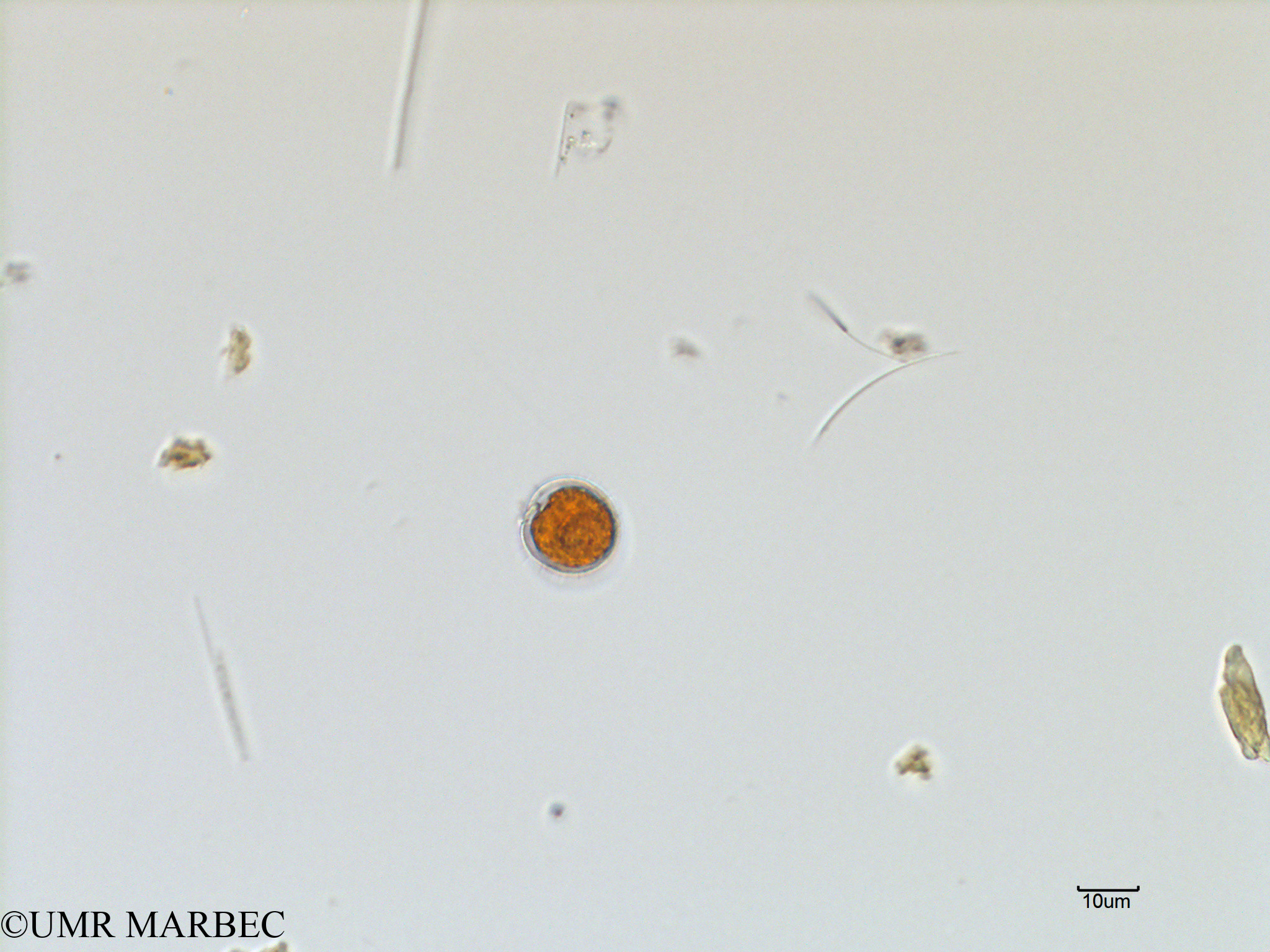 phyto/Scattered_Islands/mayotte_lagoon/SIREME May 2016/Protoperidinium sp52 (MAY3_oblea 1-7).tif(copy).jpg